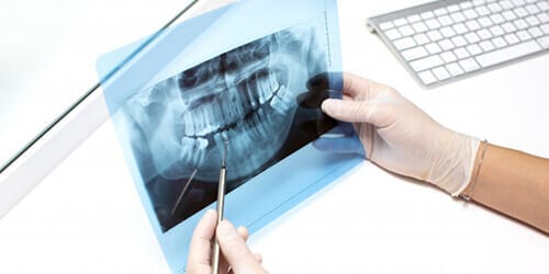 Рентгендиагностика в Усть-Каменогорске